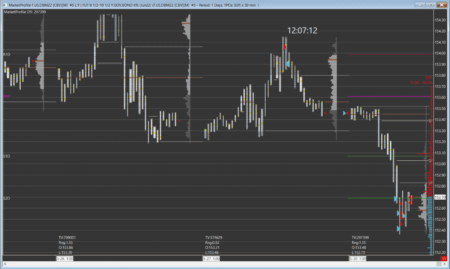 Sierra Chart - Outils - Chartbook Préconfigurés Noir - Market Profile